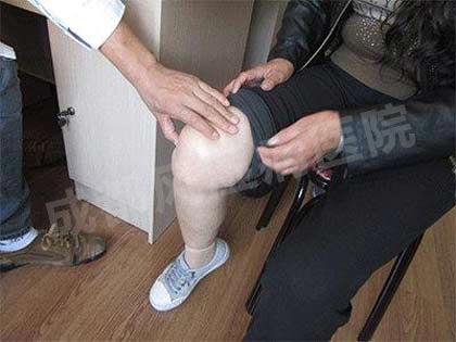 成都风湿医院医生为患者检查膝关节.jpg