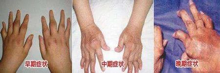 ɶʪҽԺ½ʪӮ!