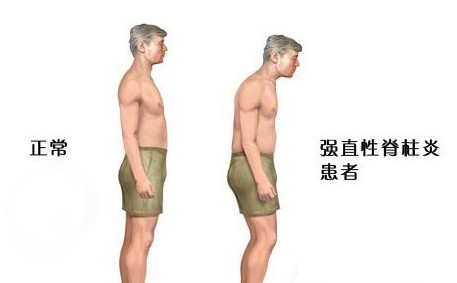 ΪʲôǿֱԼ׻Ḵ?뵶ǿֱЧ?