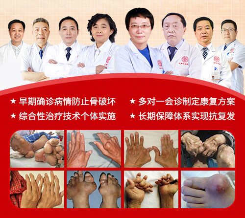 四川省中医药信息学会联成都风湿医院开展“祛炎治痛保关节”专项会诊 四川省中医药信息学会联成都风湿医院开展“祛炎治痛保关节”专项会诊
