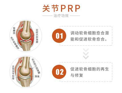 ؽ(PRP) һ롱ζֹǲ