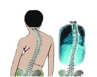 ɶרηʪҽԺĸ,ǿֱԼ׻и֢״ʲô.jpg