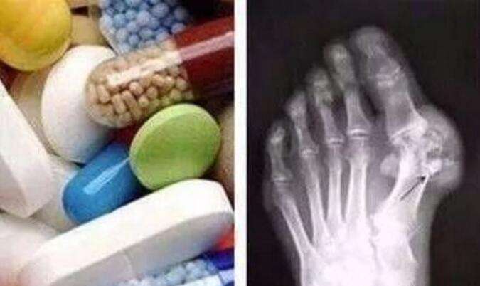 Щص,ʹ֢״ҪЩ.jpg
